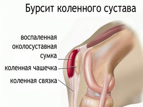 Натуральный бодибилдинг. Фото без стероидов, программа тренировок