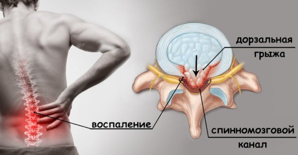 Альпинист упражнение на пресс. Как делать, техника