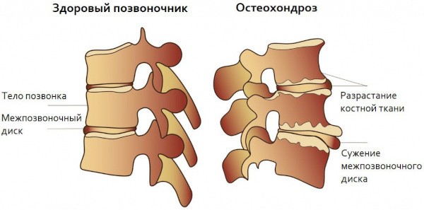 Сумо приседания с гантелью, штангой, гирей, в Смите. Техника