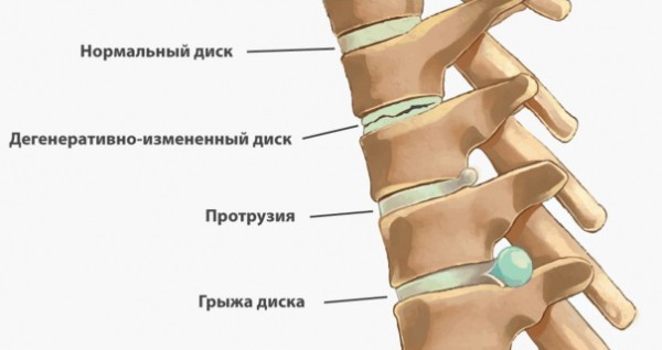 Танцевальная аэробика для похудения в домашних условиях