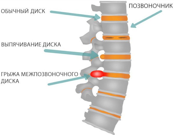 Шраги с гантелями стоя. Какие мышцы работают, техника